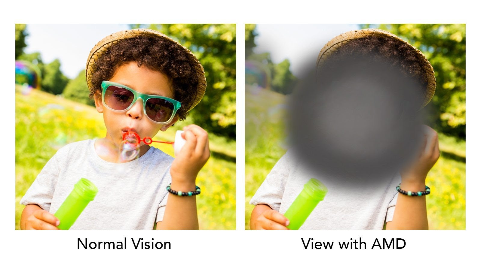 Macular Degeneration Causes, Symptoms, and Treatment Options Hopedale Local Town Pages