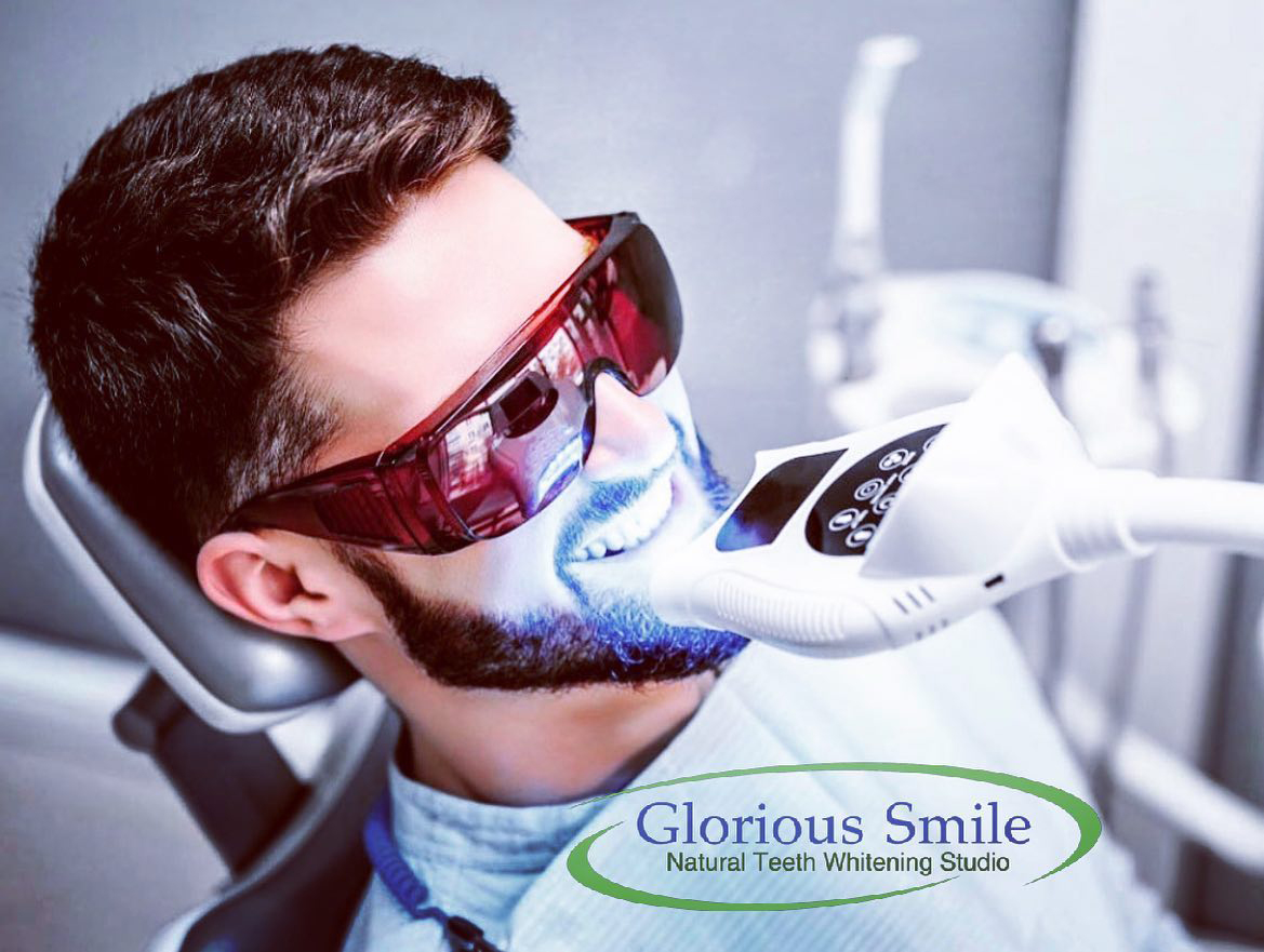 Glorious Smile Natural Teeth Whitening Style Magazine