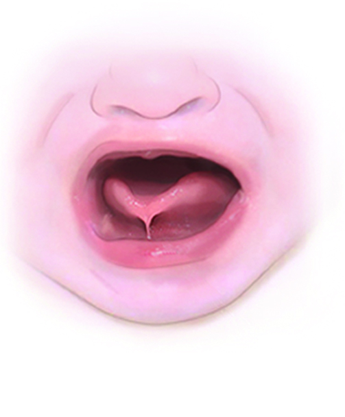 Tongue Tie Simple Diagnosis Or Symptom Natural Awakenings North Central New Jersey